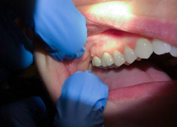 Best Emergency Dental Surgery in Glade Spring, VA
