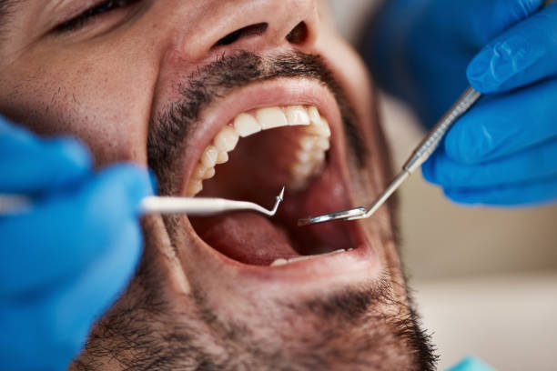 Best Emergency Broken Tooth Repair in Glade Spring, VA