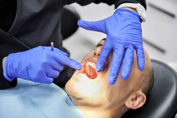 Best Emergency Tooth Extraction in Glade Spring, VA